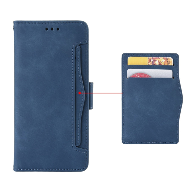For Ulefone Armor X9 Skin Feel Calf Pattern Leather Phone Case(Blue) - Ulefone Cases by buy2fix | Online Shopping UK | buy2fix